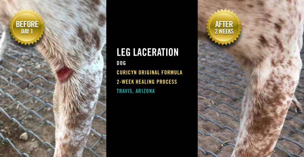 Testimonials: Leg Laceration