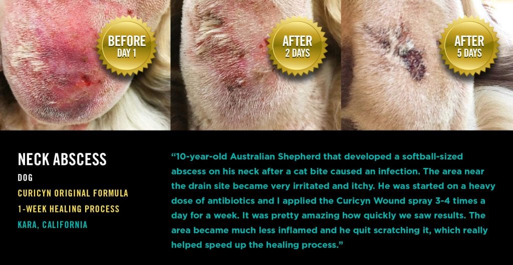 Testimonials: Neck Abscess