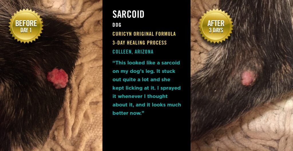 Sarcoid